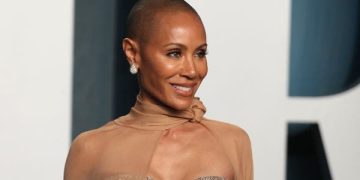 داء الثعلبة.. شهيرات تحدّثن علناً عن معاناتهن من تساقط الشعر