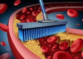 5 نصائح ولا أسهل لخفض معدلات الكوليسترول بالجسم