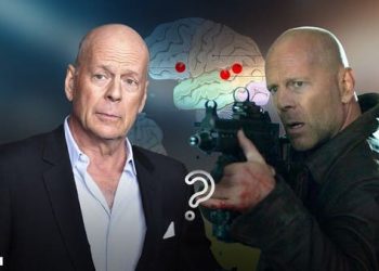 أفقد بروس ويليس القدرة على الكلام والفهم.. ما هو الحبسة؟