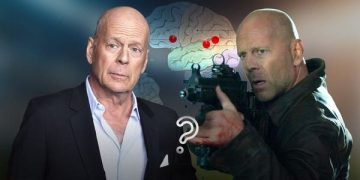 أفقد بروس ويليس القدرة على الكلام والفهم.. ما هو الحبسة؟