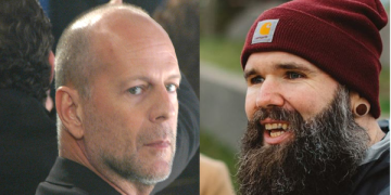 "أصبت بالحبسة مثل ويليس وتعافيت".. ممثل بريطاني يكشف